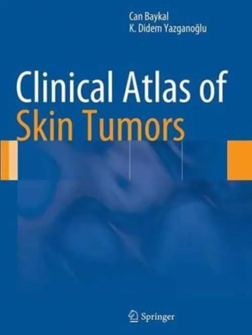 Clinical Atlas of Skin Tumors - Baykal, Can a Yazganoglu, K. Didem