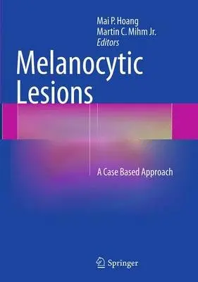 Melanocytic Lesions