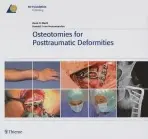 Osteotomies for Posttraumatic Deformities - Marti, Rene K. a van Heerwaarden, Ronald J.