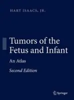 Tumors of the Fetus and Infant - Isaacs, Hart