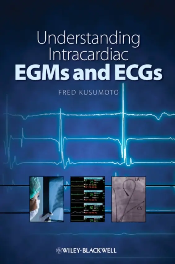 Understanding Intracardiac EGMs and ECGs - Kusumoto, Fred M.