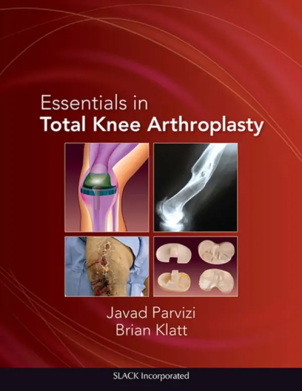 Essentials in Total Knee Arthroplasty - Parvizi, Javad a Klatt, Brian