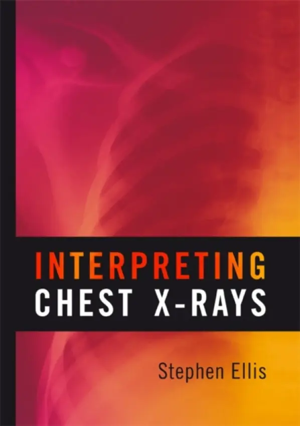 Interpreting Chest X-Rays - Ellis, Stephen
