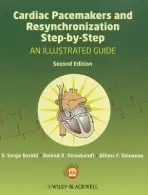 Cardiac Pacemakers and Resynchronization Step by Step - Barold, S. Serge (University of South Florida and Florida Heart Rhythm Institute) a Stroobandt, Roland X. a Sinnaeve, Alfons F.