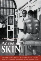 Acres of Skin - Hornblum, Allen M.