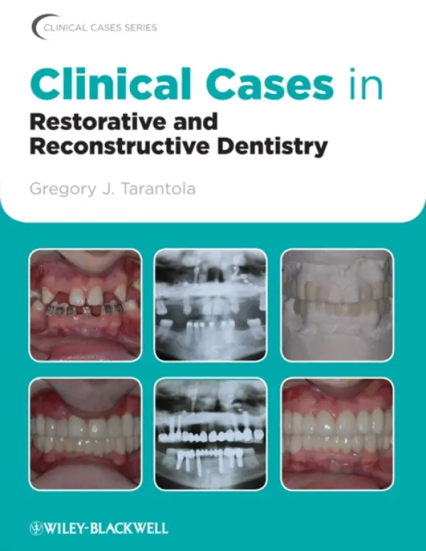 Clinical Cases in Restorative and Reconstructive Dentistry - Tarantola, Gregory J. (Private Practice, Miami, Florida a  Pankey Institute, Key Biscane, Florida)