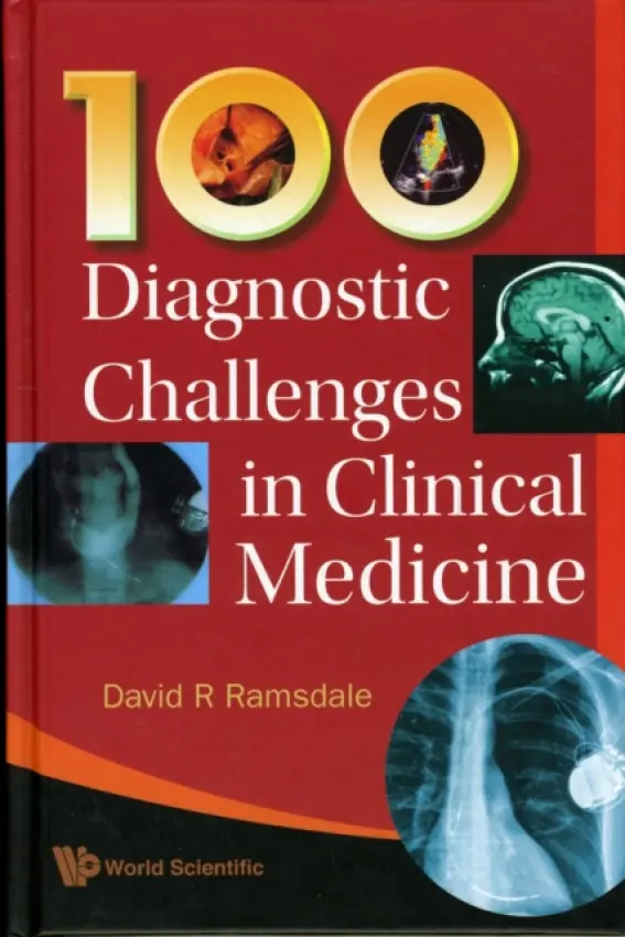 100 Diagnostic Challenges In Clinical Medicine - Ramsdale, David R (The Liverpool Heart  a  Chest Hospital, Liverpool, Uk)