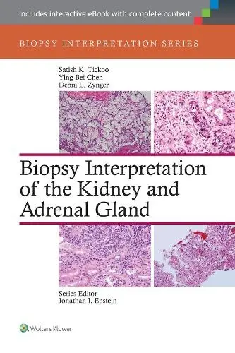 Biopsy Interpretation of the Kidney & Adrenal Gland - Tickoo, Satish a Chen, Ying-Bei a Zynger, Debra