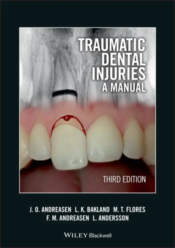 Traumatic Dental Injuries - Andreasen, Jens O. (University Hospital (Rigshospitalet), Copenhagen, Denmark) a Bakland, Leif K. (Loma Linda University, California, US) a Flores, Maria Teresa (University of Valparaiso, Valparaiso, Chile) a Andreasen, Frances M. (University Hospital (Rigshosp