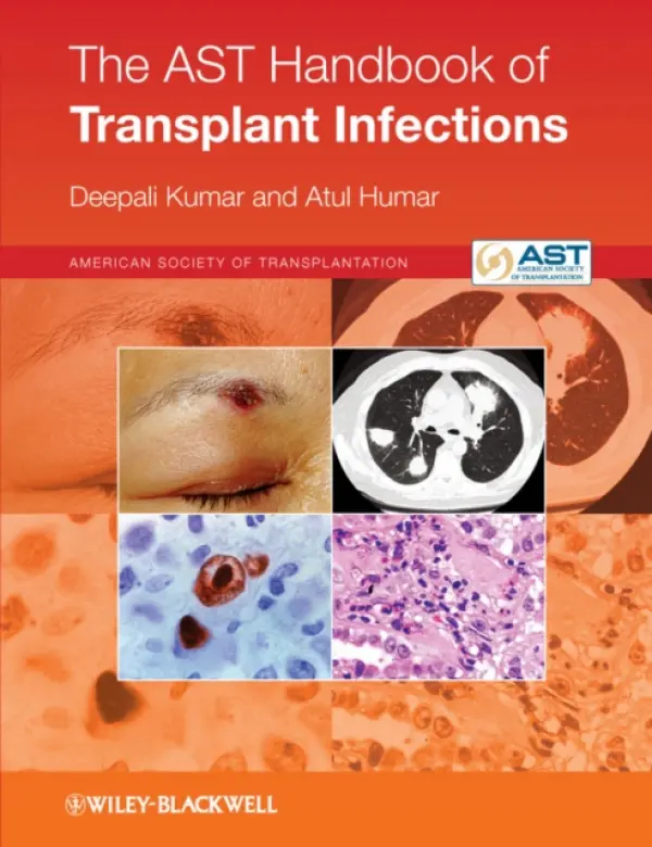 AST Handbook of Transplant Infections - Kumar, Deepali (University of Alberta) a Humar, Atul (University of Alberta)