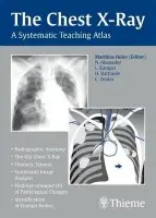 Chest X-ray Trainer - Matthias Hofer