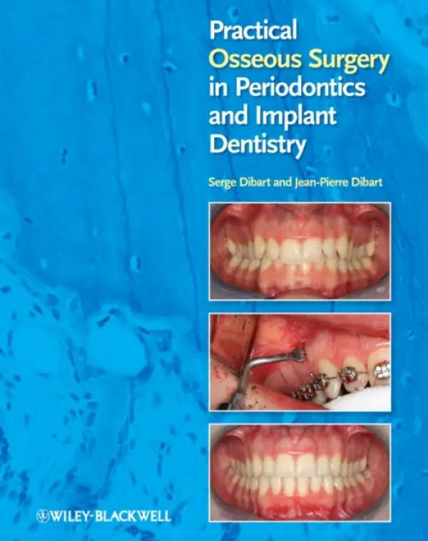 Practical Osseous Surgery in Periodontics and Implant Dentistry - Dibart, Serge (Boston University School of Dental Medicine, USA) a Dibart, Jean-Pierre (Private Practice, Marseilles, France)