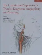 Carotid and Supra-Aortic Trunks - Henry, Michel a Diethrich, Edward B. (Arizona Heart Institute a Hospital) a Polydorou, Antonios