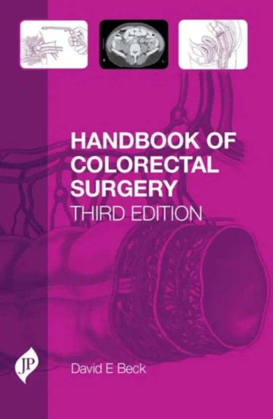 Handbook of Colorectal Surgery - Beck, David