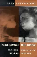 Screening the Body - Cartwright, Lisa