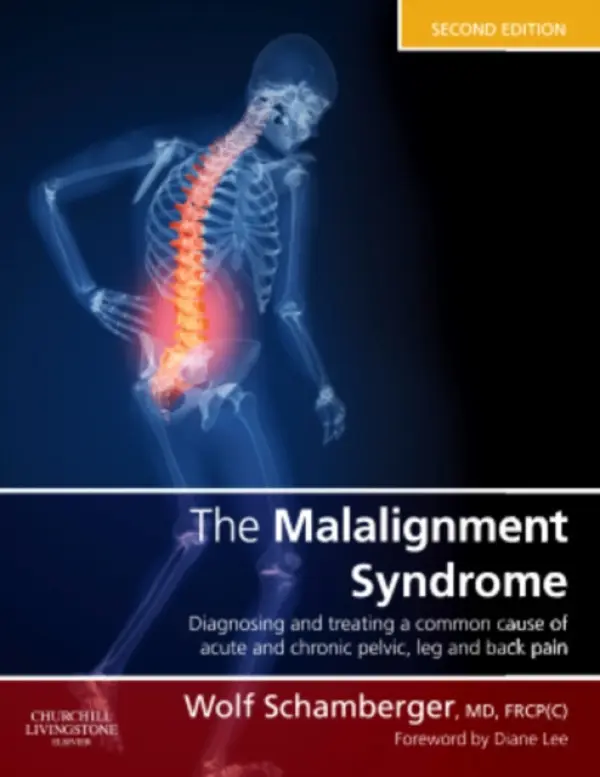 Malalignment Syndrome - Schamberger, Wolf (Clinical Associate Professor, Department of Medicine, Division of Physical Medicine and Rehabilitation and The Allan McGavin Sports Medicine Center, University of British Columbia, Vancouver, Canada)