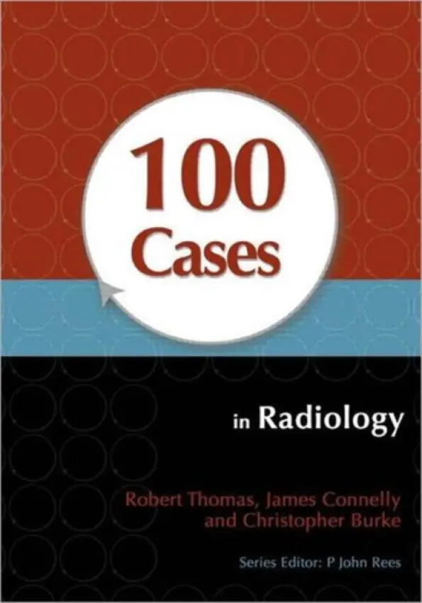 100 Cases in Radiology - Thomas, Robert (Specialist Registrar, Guy’s and St Thomas’ Hospital, London, UK) a Connelly, James (Specialist Registrar, Guy’s and St Thomas’ Hospital, London, UK) a Burke, Christopher (Specialist Registrar, Guy’s and St Thomas’ Hospital, London, UK)