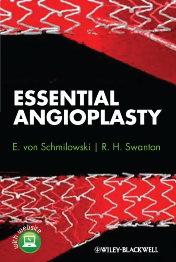 Essential Angioplasty - von Schmilowski, E. (SpR Cardiologist The Heart Hospital) a Swanton, R. H. (Consultant Cardiologist The Heart Hospital)