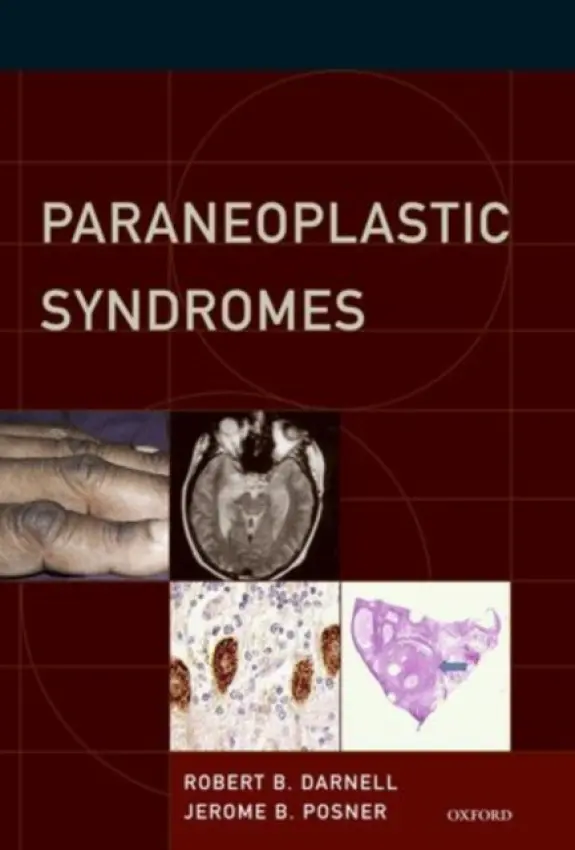 Paraneoplastic Syndromes - Darnell, Robert B. (Investigator, Howard Hughes Medical Institute, Heilbrunn Cancer Professor and Senior Physician, Investigator, Howard Hughes Medical Institute, Heilbrunn Cancer Professor and Senior Physician, The Rockefeller University, New York, NY.,