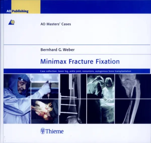 Minimax Fracture Fixation - Weber, Bernhard G.