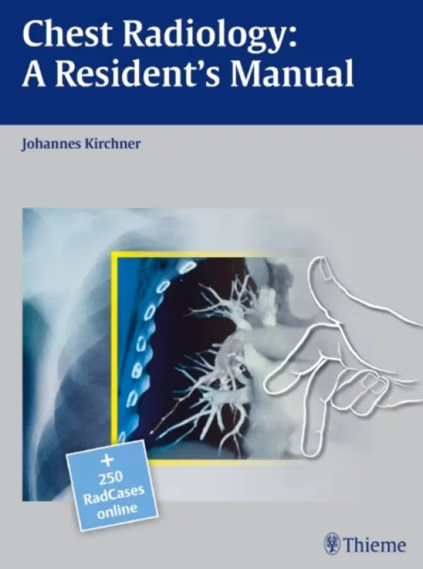 Chest Radiology: a Resident's Manual - Kirchner, Johannes