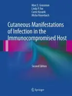 Cutaneous Manifestations of Infection in the Immunocompromised Host - Grossman, Marc E. a Fox, Lindy P. a Kovarik, Carrie a Rosenbach, Misha