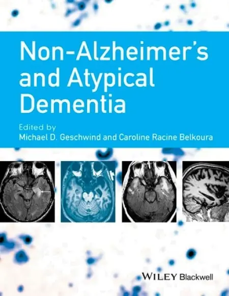 Non-Alzheimer's and Atypical Dementia