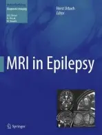 MRI in Epilepsy