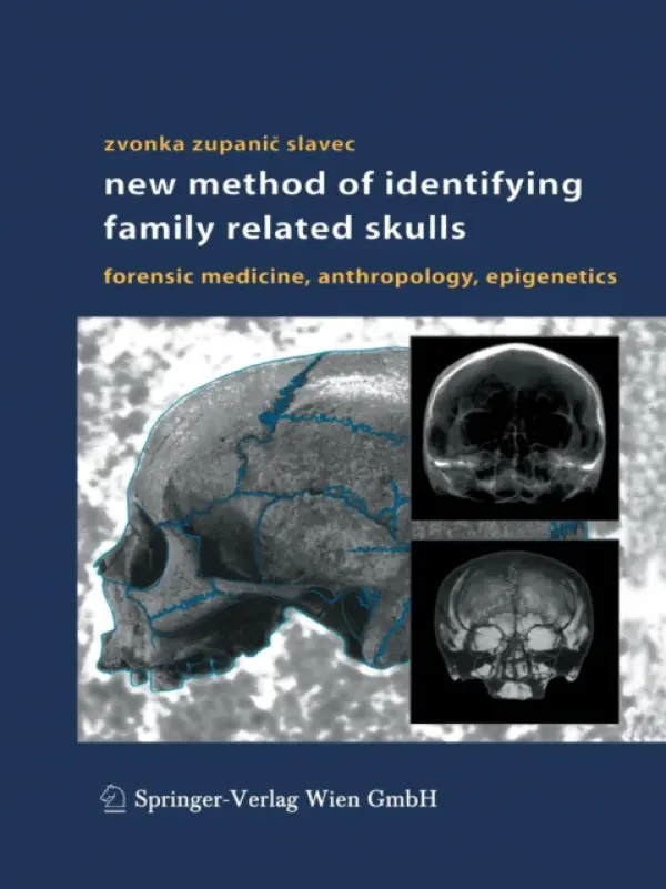 New Method of Identifying Family Related Skulls - Zupanic Slavec, Zvonka