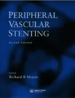 Peripheral Vascular Stenting, Second Edition