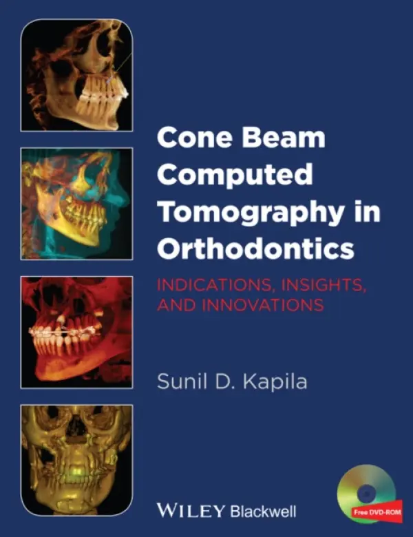 Cone Beam Computed Tomography in Orthodontics - Kapila, Sunil D. (University of Michigan School of Dentistry, Ann Arbor, Michigan, USA.)