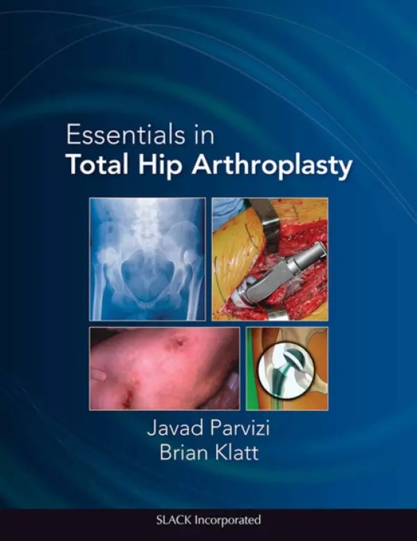 Essentials in Total Hip Arthroplasty - Parvizi, Javad a Klatt, Brian
