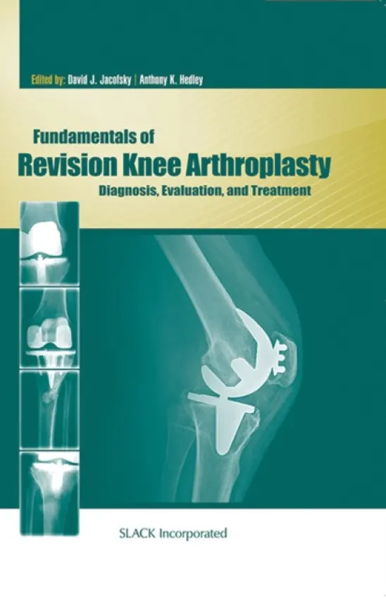 Fundamentals of Revision Knee Arthroplasty - Jacofsky, David a Hedley, Anthony