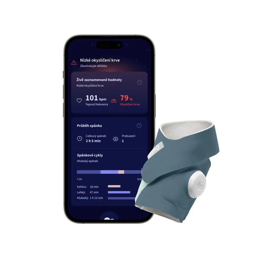 Owlet Dream SockTM – Chytrá ponožka 0-18 měsíců -