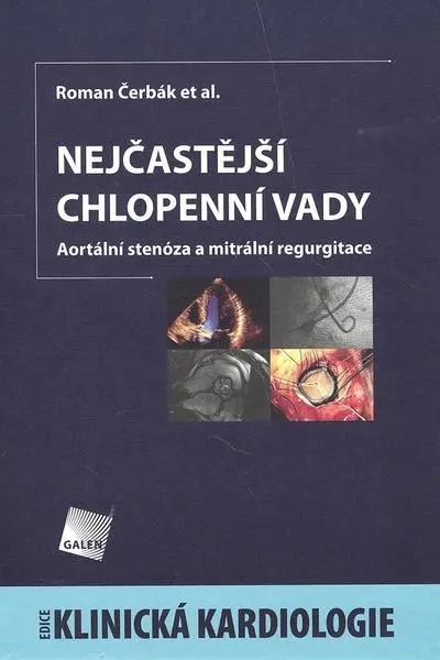 Nejčastější chlopenní vady - Roman Čerbák