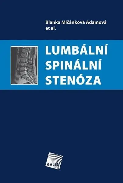 Lumbální spinální stenóza - Adamová Blanka Mičánková