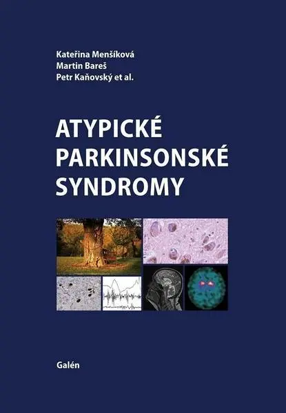 Atypické parkinsonské syndromy - Kateřina Menšíková