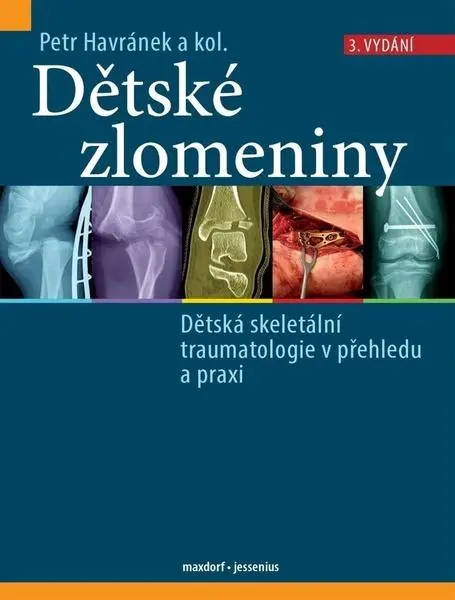 Dětské zlomeniny - Dětská skeletální traumatologie v přehledu a praxi