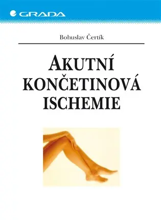 Akutní končetinová ischemie