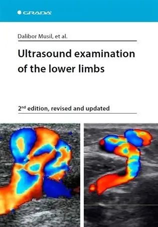 Ultrasound examination of the lower limbs