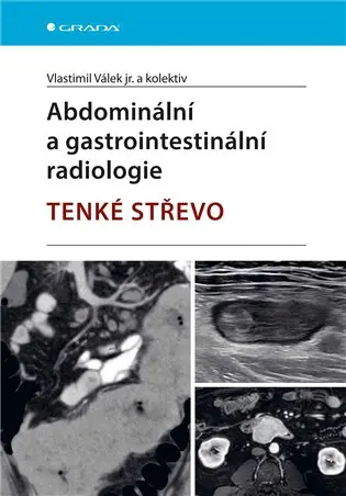 Abdominální a gastrointestinální radiologie - Játra