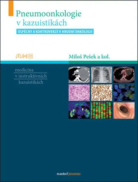 Pneumoonkologie v kazuistikách