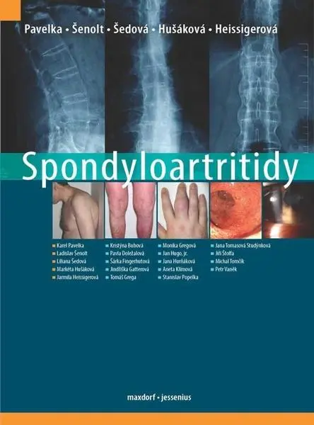 Spondyloartritidy - Karel Pavelka