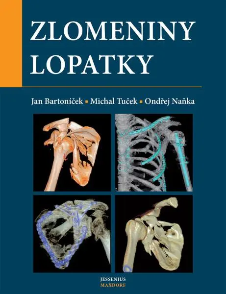 Zlomeniny lopatky - Jan Bartoníček; Michal Tuček; Ondřej Naňka