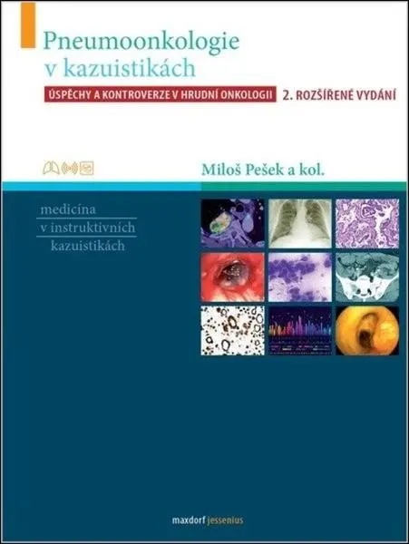 Pneumoonkologie v kazuistikách - Úspěchy a kontroverze v hrudní chirurgii