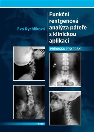 Funkční rentgenová analýza páteře s klinickou aplikací - Eva Rychlíková