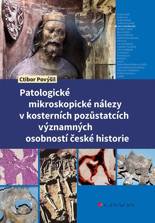 Patologické mikroskopické nálezy v kosterních pozůstatcích významných osobností české hist - Ctibor Povýšil