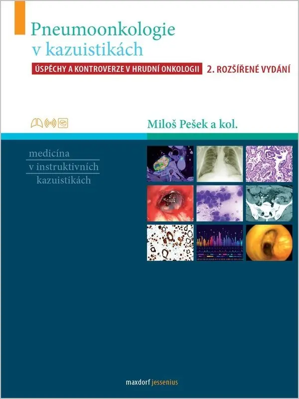 Pneumoonkologie v kazuistikách - Úspěchy a kontroverze v hrudní chirurgii - kolektiv autorů