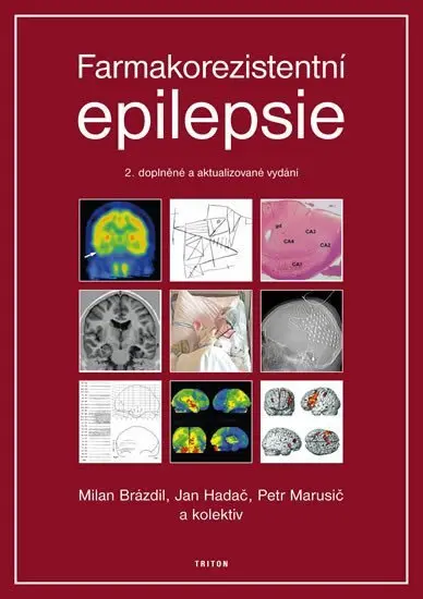 Farmakorezistentni epilepsie - 2. vydání -  kolektiv autorů