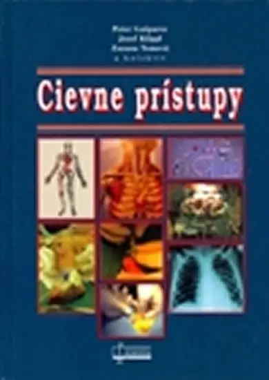 Cievne prístupy - Peter Gašparec